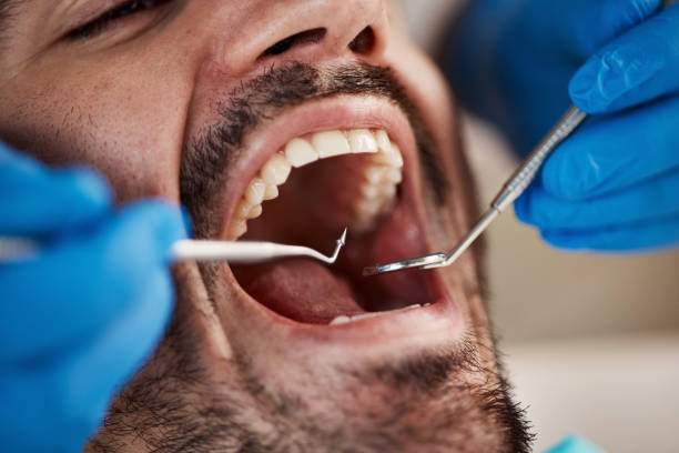 Best Emergency Treatment for Dental Infections or Abscesses in Crookston, MN